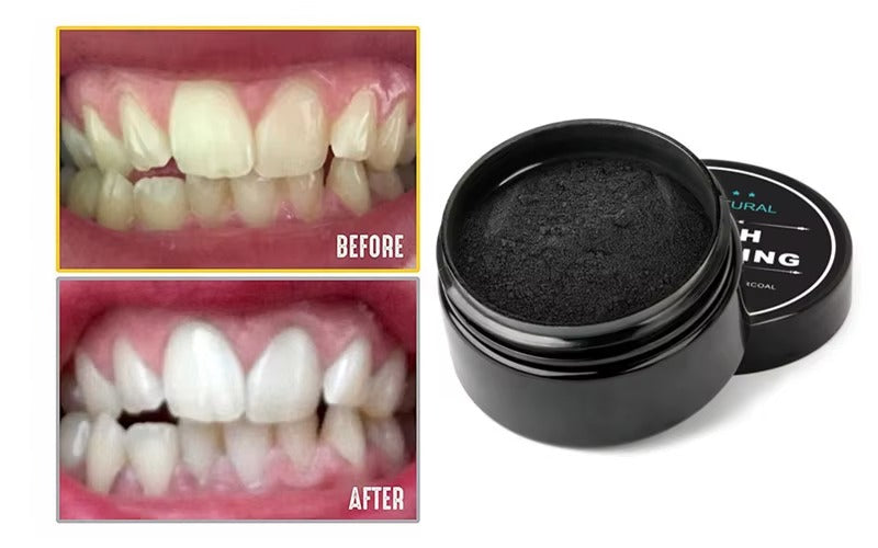 POLVO DE CARBON BLANQUEADOR DENTAL 30G